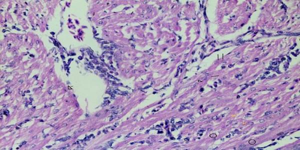 Role of histopathological examination in diagnosis of avian leucosis virus subtype J in broiler chicken in Egypt - Image 11