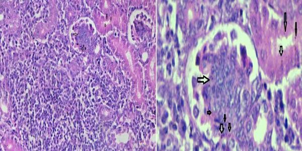 Role of histopathological examination in diagnosis of avian leucosis virus subtype J in broiler chicken in Egypt - Image 22