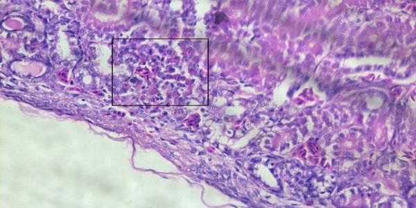 Role of histopathological examination in diagnosis of avian leucosis virus subtype J in broiler chicken in Egypt - Image 21