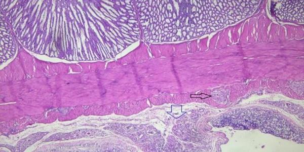 Role of histopathological examination in diagnosis of avian leucosis virus subtype J in broiler chicken in Egypt - Image 28