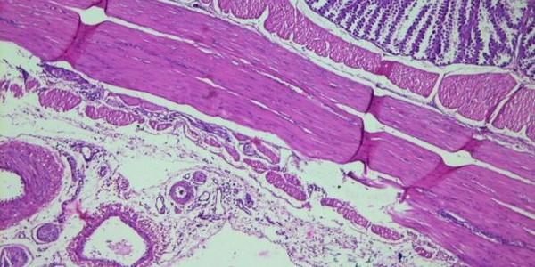 Role of histopathological examination in diagnosis of avian leucosis virus subtype J in broiler chicken in Egypt - Image 26