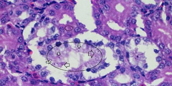 Role of histopathological examination in diagnosis of avian leucosis virus subtype J in broiler chicken in Egypt - Image 23