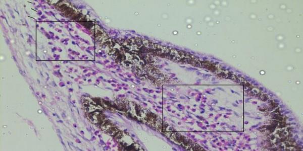 Role of histopathological examination in diagnosis of avian leucosis virus subtype J in broiler chicken in Egypt - Image 24