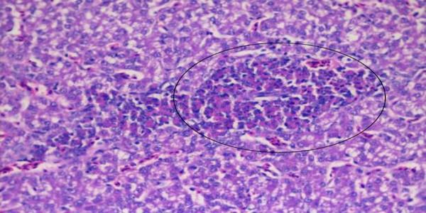 Role of histopathological examination in diagnosis of avian leucosis virus subtype J in broiler chicken in Egypt - Image 7