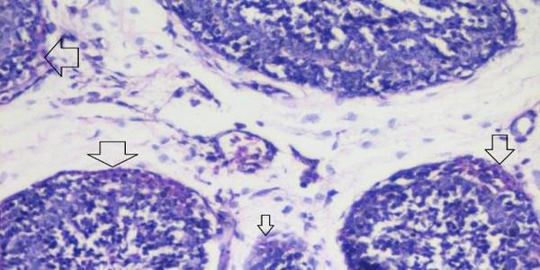 Role of histopathological examination in diagnosis of avian leucosis virus subtype J in broiler chicken in Egypt - Image 30