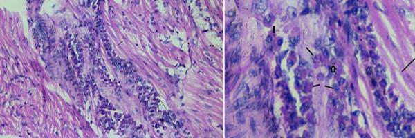 Role of histopathological examination in diagnosis of avian leucosis virus subtype J in broiler chicken in Egypt - Image 10