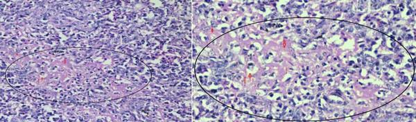 Role of histopathological examination in diagnosis of avian leucosis virus subtype J in broiler chicken in Egypt - Image 16