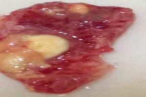 Case Report: Prevalence and significance of aspergellosis in commercial broiler chicken: Pathological study - Image 3