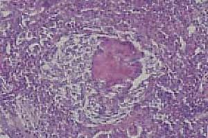 Case Report: Prevalence and significance of aspergellosis in commercial broiler chicken: Pathological study - Image 4