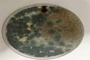 Case Report: Prevalence and significance of aspergellosis in commercial broiler chicken: Pathological study - Image 6