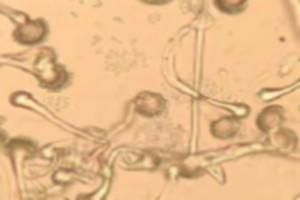 Case Report: Prevalence and significance of aspergellosis in commercial broiler chicken: Pathological study - Image 7