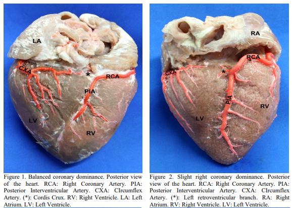 Evaluation of coronary dominance in pigs; a comparative study with findings in human hearts - Image 3