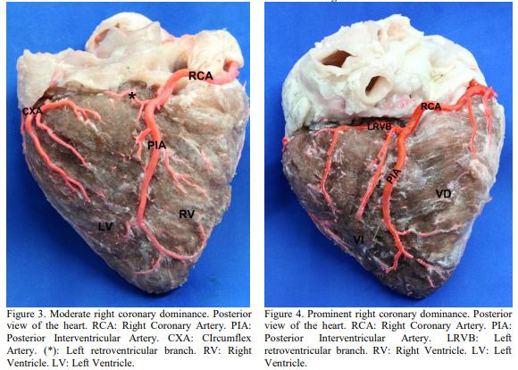Evaluation of coronary dominance in pigs; a comparative study with findings in human hearts - Image 4