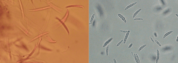 Identification and Control of Fusarium Head Blight (Scab) of Wheat in Georgia - Image 1
