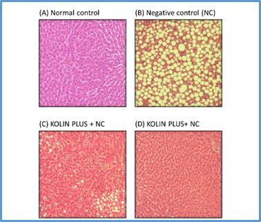 Fat metabolism: can improve poultry performance - Image 5