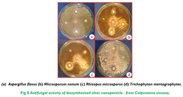 Biosynthesis and Characterization of Silver Nanoparticles from Marine Seaweed Colpomenia Sinuosa and its Antifungal Efficacy - Image 8