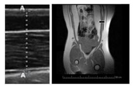 Metformin Alleviates Obesity and Systemic Oxidative Stress in Obese Young Swine - Image 4