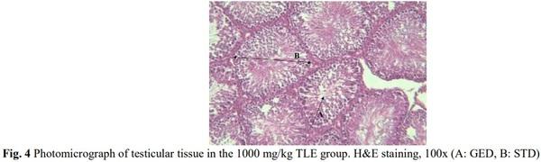 Evaluation of Sperm Parameters, Reproductive Hormones, Histological Criteria, and Testicular Spermatogenesis Using Turnip Leaf (Brassica Rapa) Hydroalcoholic Extract in Male Rats: An Experimental Study - Image 7