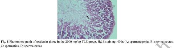 Evaluation of Sperm Parameters, Reproductive Hormones, Histological Criteria, and Testicular Spermatogenesis Using Turnip Leaf (Brassica Rapa) Hydroalcoholic Extract in Male Rats: An Experimental Study - Image 11