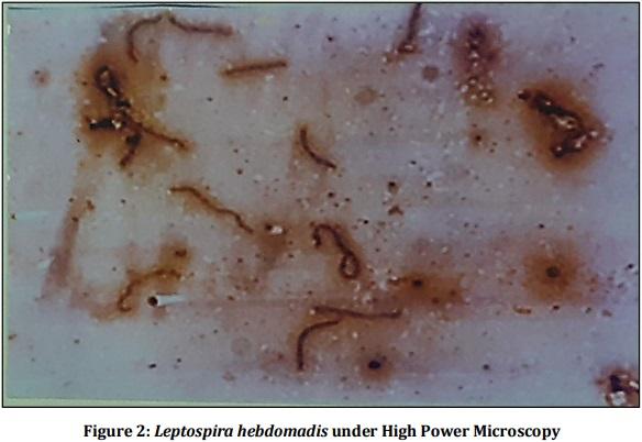 Vaccine Preperative Trial for Leptospirosis and their Pathological, Immunological Study by Serum Electrophoresis - Image 2