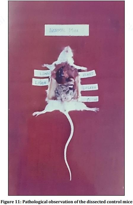 Vaccine Preperative Trial for Leptospirosis and their Pathological, Immunological Study by Serum Electrophoresis - Image 15