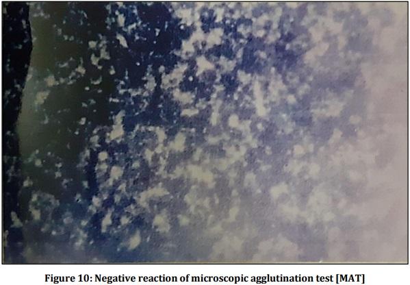 Vaccine Preperative Trial for Leptospirosis and their Pathological, Immunological Study by Serum Electrophoresis - Image 14