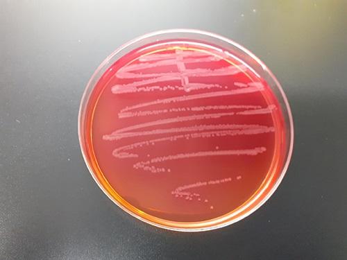 Vaccine strain differentiation: an essential factor in monitoring and controlling salmonellosis in poultry - Image 2