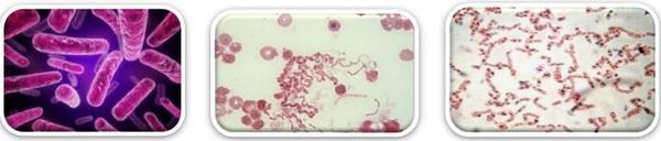 Importances of Photosynthesis Bacteria in Pond Management and Health Performances in Aquaculture - Image 1