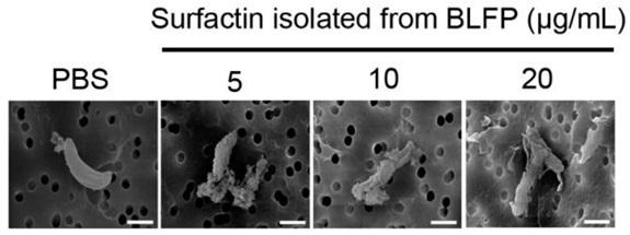 Effectiveness of Bacillus licheniformis-Fermented Products and Their Derived Antimicrobial Lipopeptides in Controlling Coccidiosis in Broilers (Extract) - Image 7