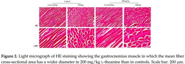 Influence of Graded Levels of L-Theanine Dietary Supplementation on Growth Performance, Carcass Traits, Meat Quality, Organs Histomorphometry, Blood Chemistry and Immune Response of Broiler Chickens - Image 7