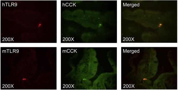 Toll-like receptor 9 expressed in proximal intestinal enteroendocrine cells detects bacteria resulting in secretion of cholecystokinin - Image 2