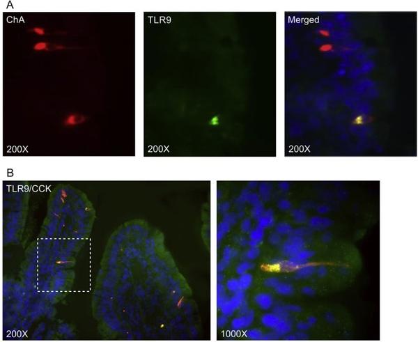 Toll-like receptor 9 expressed in proximal intestinal enteroendocrine cells detects bacteria resulting in secretion of cholecystokinin - Image 1