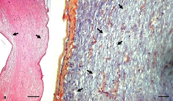 Cervical scoliosis and torticollis: a novel skeletal anomaly in broiler chickens - Image 6