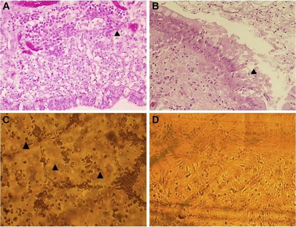 Research Note: Molecular and pathologic characterization of avian adenovirus isolated from the oviducts of laying hens in eastern Japan - Image 1