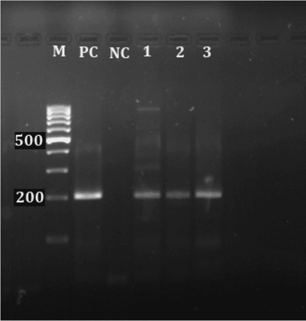 Monitoring of aquatic birds and surveillance of avian influenza and Newcastle disease of waterfowls at the National Park of Urmia Lake - Image 17