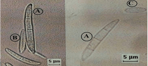 Identification and Production of Beauvericin by Fusarium subglutinansand F. sacchari from Sugarcane - Image 2
