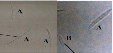 Identification and Production of Beauvericin by Fusarium subglutinansand F. sacchari from Sugarcane - Image 6
