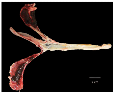FIGURE 7 | Severe lesions in ceca sacs of SPF White Leghorn chick infected with a high dose of sporulated oocysts of E. tenella, this bird did not receive any treatment of immunotherapy based in purified egg yolk immunoglobulins (IgY) of Supracox during prepatent period, at least 25% of these birds died through this time.