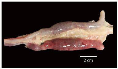 FIGURE 6 | Severe lesions in both ceca sacs of SPF White Leghorn chick infected with a high dose of sporulated oocysts of E. tenella and treated by oral gavage with purified egg yolk immunoglobulins (60 mg IgY) of Supracox during prepatent period, all birds from this group recovered quickly after the patency period.