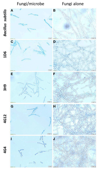 FIGURE 5 | The effects of the candidate endophytes on F. graminearum in vitro using the vitality stain, Evans blue. Shown are representative microscope slide pictures (n = 3) of the interactions of F. graminearum with: (A) the commercial biological control agent, Bacillus subtilis (100 mg/10 ml) compared to (B) the buffer control; (C) Strain 1D6 compared to (D) the buffer control; (E) strain 3H9 compared to (F) the buffer control; (G) Strain 4G12 compared to (H) the buffer control; (I) Strain 4G4 compared to (J) the buffer control.