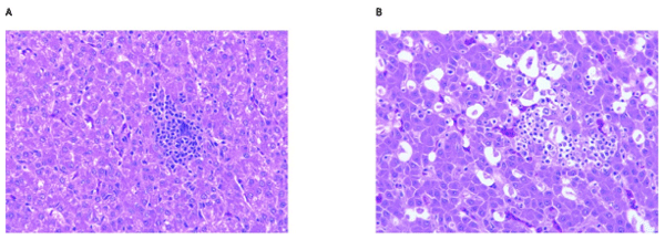 Fig 7. Representative micrographs of a chicken liver. (A) Section taken at Day21. (B) Section taken at Day 42.