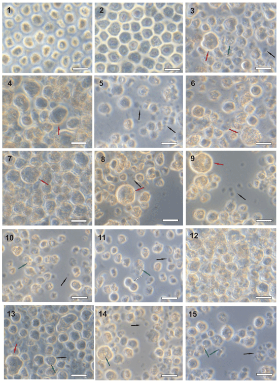 Fig 4. Examples of characteristic mycotoxin-induced morphological changes in THP-1 cells. (1) untreated THP-1 control—C1, (2) THP-1 control treated with solvent—C2, (3) aflatoxicol, (4) aflatoxin B2, (5) aflatoxin G2, (6) cyclosporin C, (7) cyclosporin H, (8) cytochalasin C, (9) diacetoxyscripenol, (10) fumigaclavine A, (11) moniliformin, (12) ochratoxin A, (13) patulin, (14) paxilline, (15) sterigmatocystin. White arrow—mitotic cells, red arrow—swelled and deformed cell, green arrow—vacuoles, black arrow—fragments of disintegrated cells. Scale bars: 50 μm.