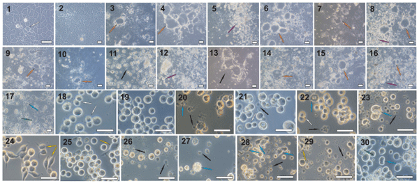 Fig 3. Examples of characteristic mycotoxin-induced morphological changes in Caco-2 and Sf-9 cells. (1) untreated Caco-2 control—C1, (2) Caco-2 control treated with solvent—C2, (3) Caco-2 treated aflatoxicol, (4) Caco-2 treated 3-acetyldeoxynivalenol, (5) Caco-2 treated aflatoxin B1, (6) Caco-2 treated aflatoxin G2, (7) Caco-2 treated α-amanitin, (8) Caco-2 treated antibiotic PF 1052, (9) Caco-2 treated cyclosporin H, (10) Caco-2 treated cytochalasin B, (11) Caco-2 treated gliotoxin, (12) Caco-2 treated HT-2 toxin, (13) Caco-2 treated roquefortine C, (14) Caco-2 treated stachybotrylactam, (15) Caco-2 treated T2 tetraol, (16) Caco-2 treated wortmannin, (17) Caco-2 treated zearalenone, (18) untreated Sf-9—C1, (19) Sf-9 treated with solvent—C2, (20) Sf-9 treated 3-acetyldeoxynivalenol, (21) Sf-9 treated aflatoxin B2, (22) Sf-9 treated alternariol, (23) Sf-9 treated alternariol-9-methyl ether, (24) Sf-9 treated fumonisin B2, (25) Sf-9 treated neosolaniol, (26) Sf-9 treated ochratoxin A, (27) Sf-9 treated patulin, (28) Sf-9 treated stachybotrylactam, (29) Sf-9 treated T2 tetraol, (30) Sf-9 treated verruculogen. White arrow—mitotic cells, yellow arrow—spindle cell, green arrow—vacuoles, blue arrow—malformed cell, orange arrow—monolayer surface protrusions, purple arrow—cells detached from the monolayer, black arrow—fragments of disintegrated cells. Scale bars: 50 μm.
