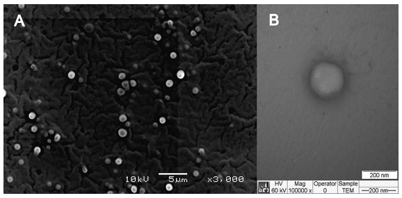 FIGURE 4 | Morphological features of NLC (F6) formulation in terms of FE-SEM (A) and TEM (B) images.