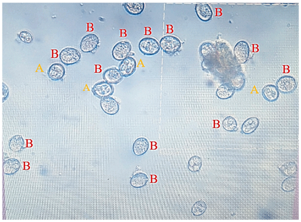 Figure 2. Microscopic observation of the changes that appeared on the oocysts when exposed to various treatments. A shows the sporulated oocysts; and B shows the unsporulated oocysts (400×).