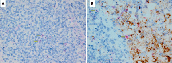 Newcastle Disease Virus Induces Profound Lymphoid Depletion with Different Patterns of Necroptosis, Necrosis, and Oxidative DNA Damage in Bursa, Spleen, and Other Lymphoid Tissues - Image 7