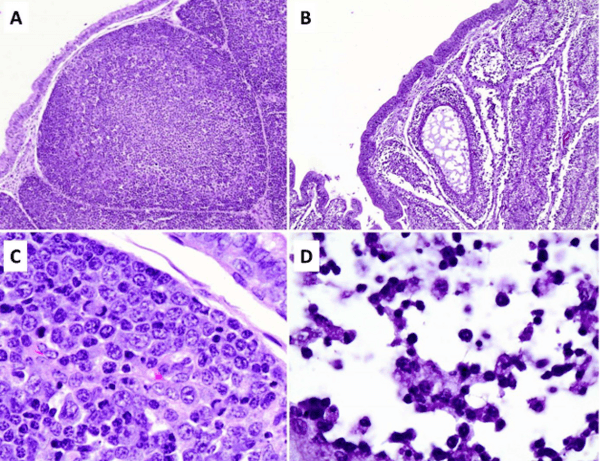 Newcastle Disease Virus Induces Profound Lymphoid Depletion with Different Patterns of Necroptosis, Necrosis, and Oxidative DNA Damage in Bursa, Spleen, and Other Lymphoid Tissues - Image 4