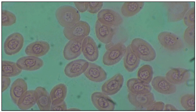 Figure-5: Treatment 2 (T2).