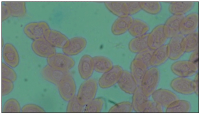 Figure-4: Treatment 1 (T1).