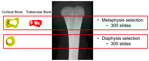 Figure 1. The region of interest selection for the analysis. The same ROI was selected for all the samples. For the metaphysis, 300 slides (7.5 mm) were selected and for the diaphysis, 300 slides (7.5 mm) were selected.